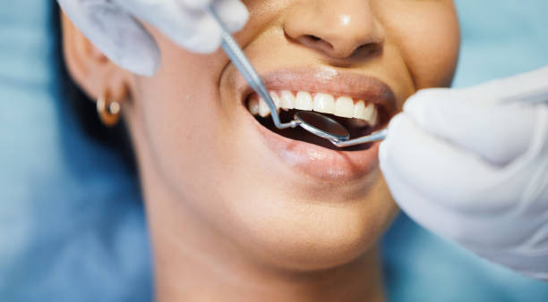 Best Urgent Tooth Repair  in Maywood Park, OR